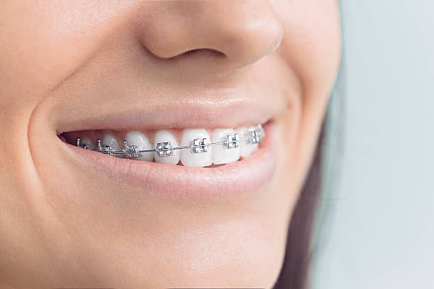 Dental Inlays and Onlays in Port Clinton, OH